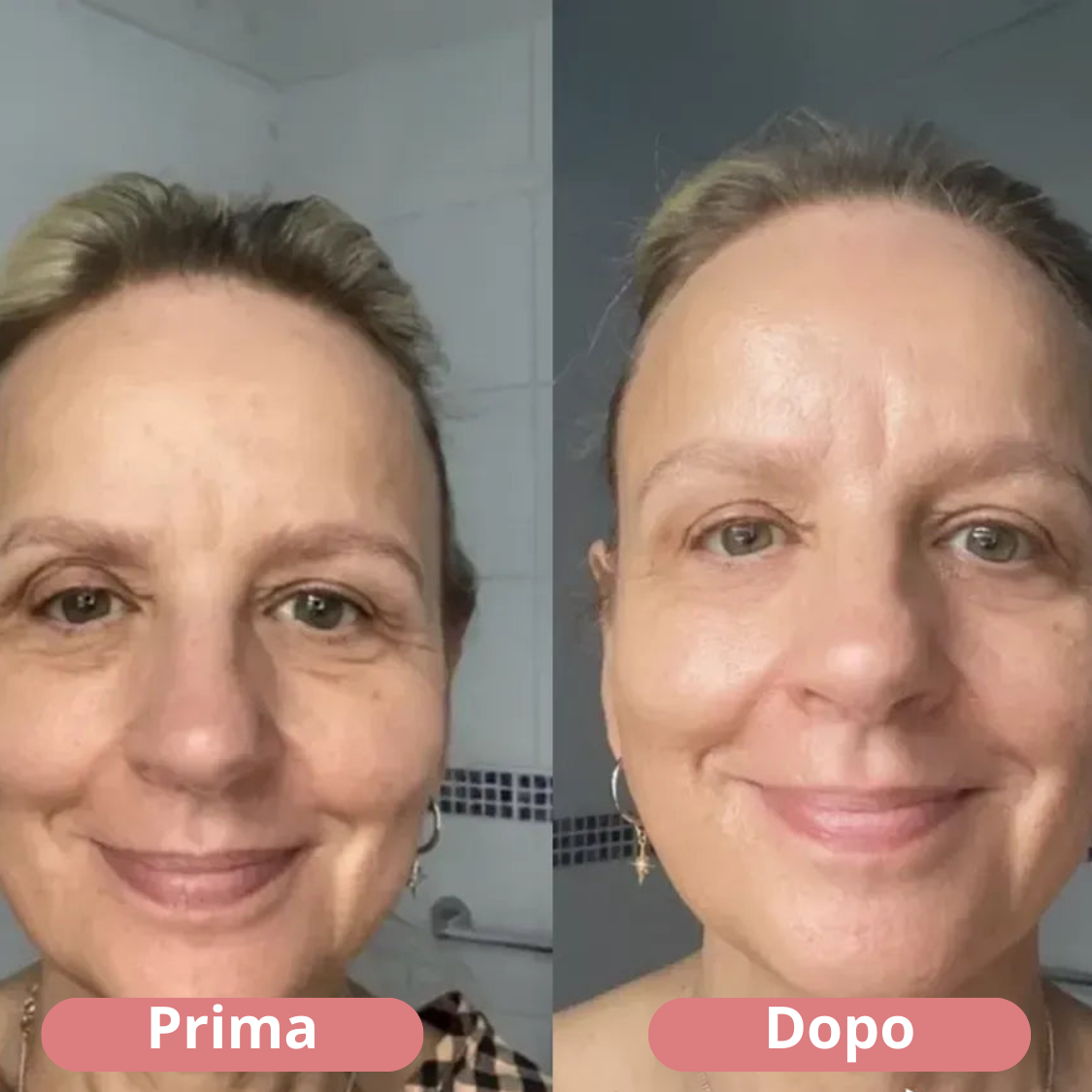 Perfection Eye Tightener