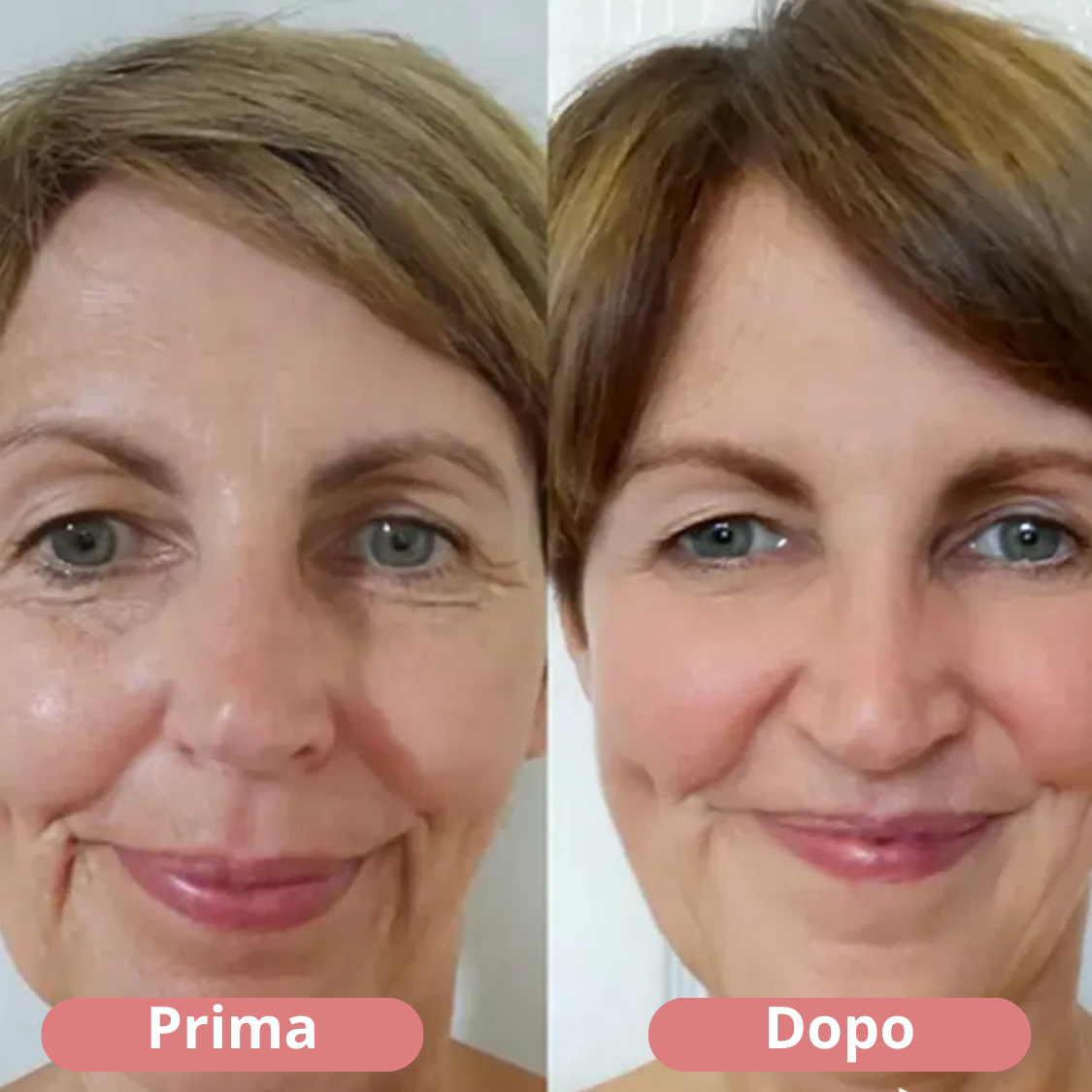 Perfection Eye Tightener